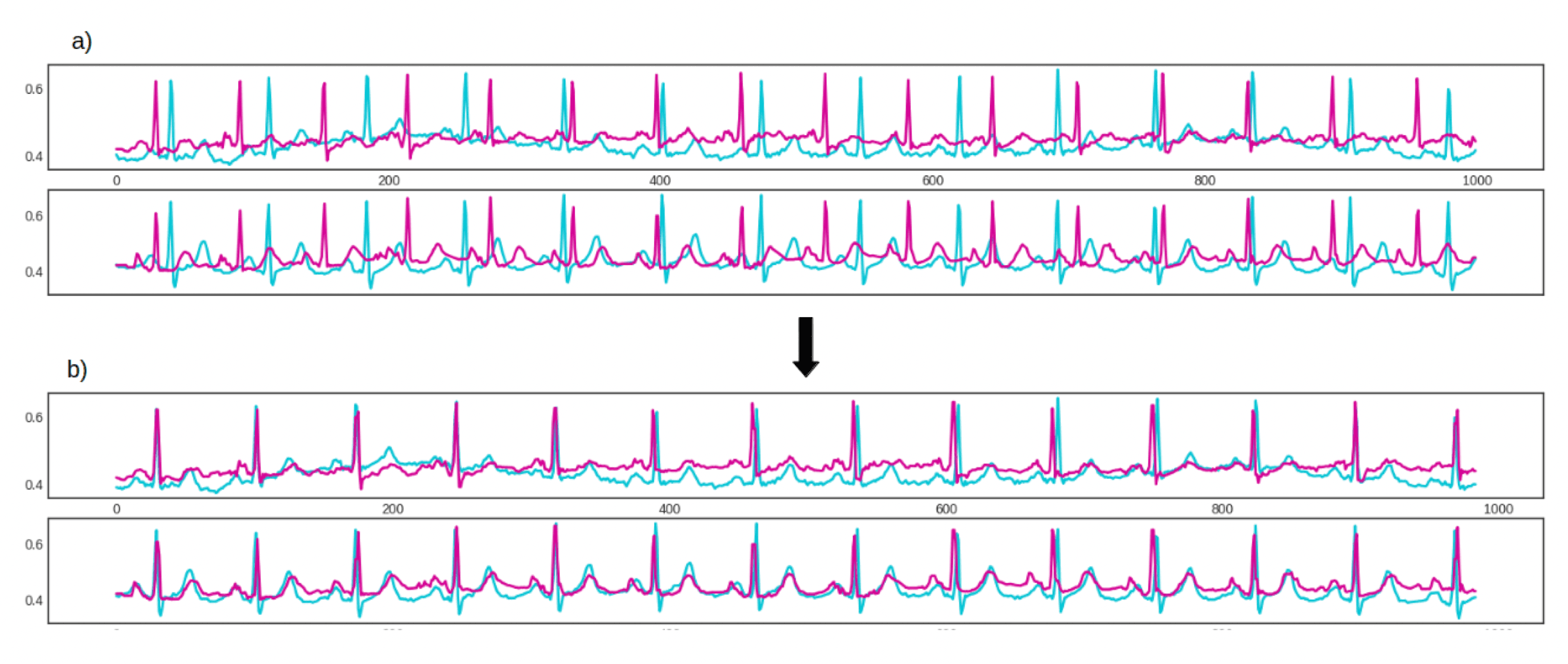 Two ECG traces before and after synchronisation, shown for two leads.